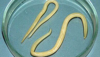 How to properly accept tests for asworm disease