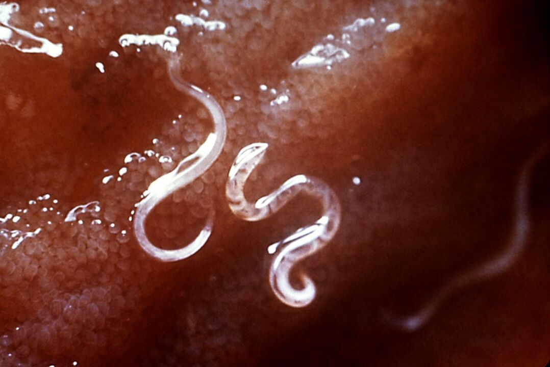 parasites in human body