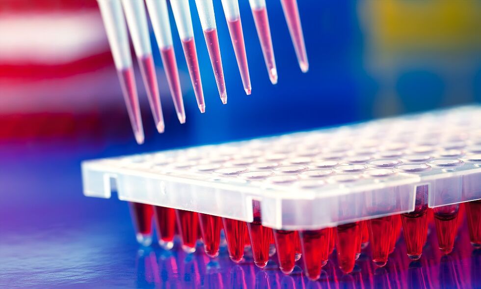 Enzyme immunoassay blood test - a way to diagnose parasitic infections